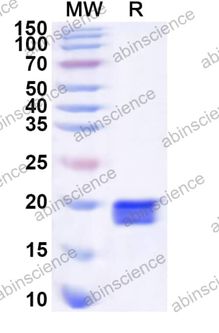 Human EMX2 Recombinant Protein (N-His)