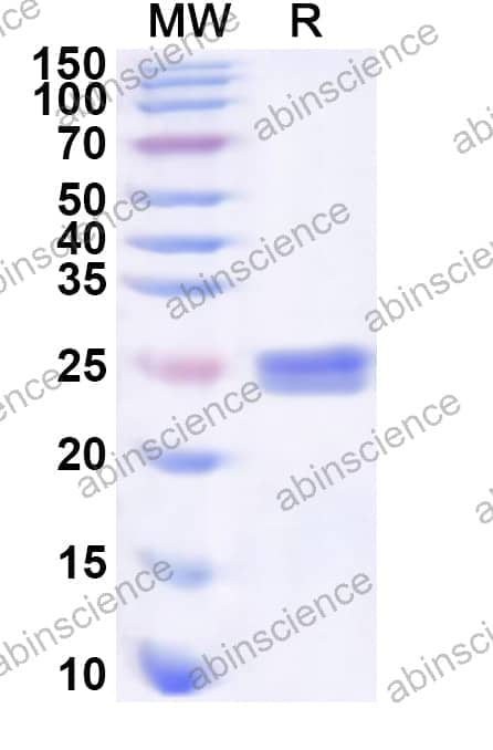 Human SRSF11 Recombinant Protein (N-His)