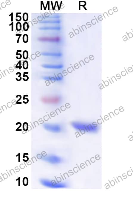 Human VEZF1 Recombinant Protein (N-His)