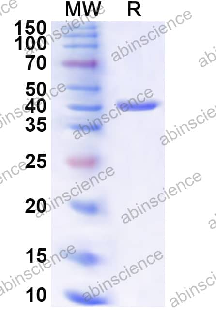 Human POLA2 Recombinant Protein (N-His)