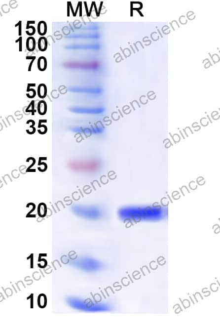 Human SLBP Recombinant Protein (N-His)