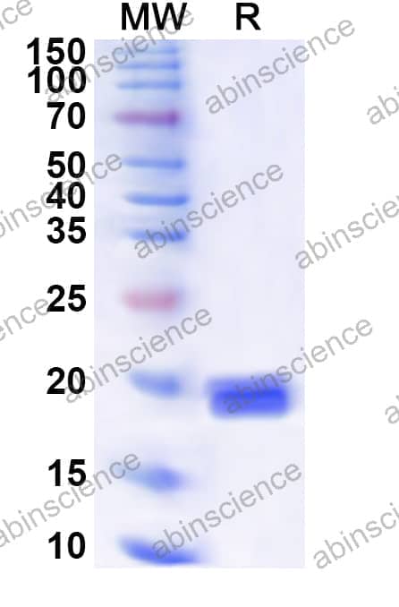 Human HIC1 Recombinant Protein (N-His)