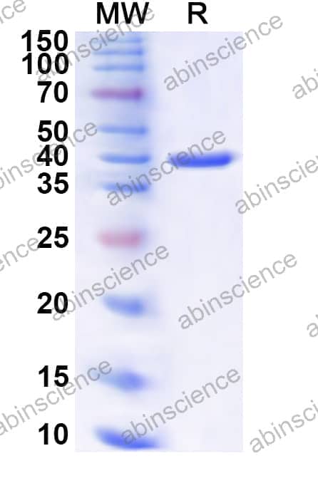Human KRT32 Recombinant Protein (N-His)