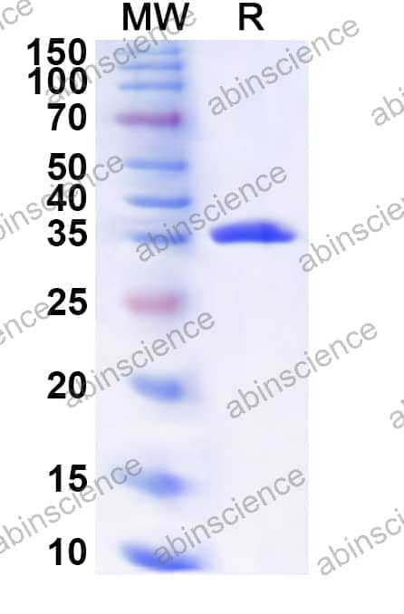 Human NFATC4 Recombinant Protein (N-His)