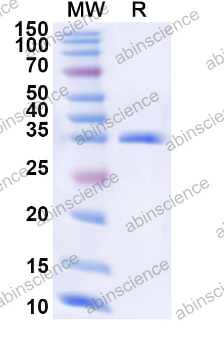 Human CLCA4 Recombinant Protein (N-His)