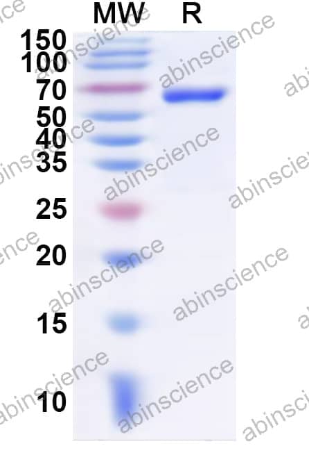 Human GRM7 Recombinant Protein (N-His)