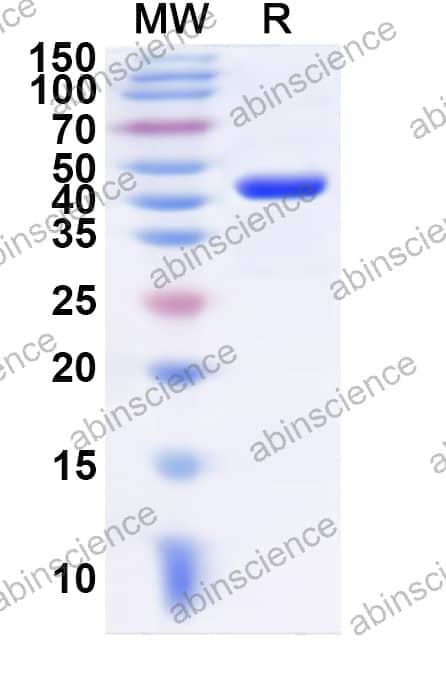 Human KRT72 Recombinant Protein (N-His)