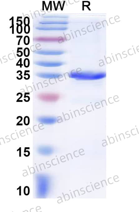 Human EXOSC7 Recombinant Protein (N-His)
