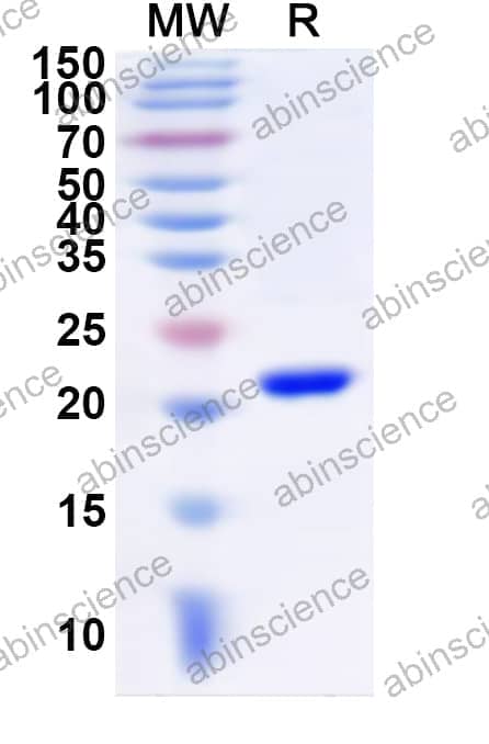 Human JOSD1 Recombinant Protein (N-His)