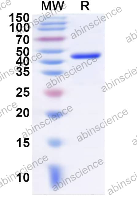 Human NCF4 Recombinant Protein (N-His)