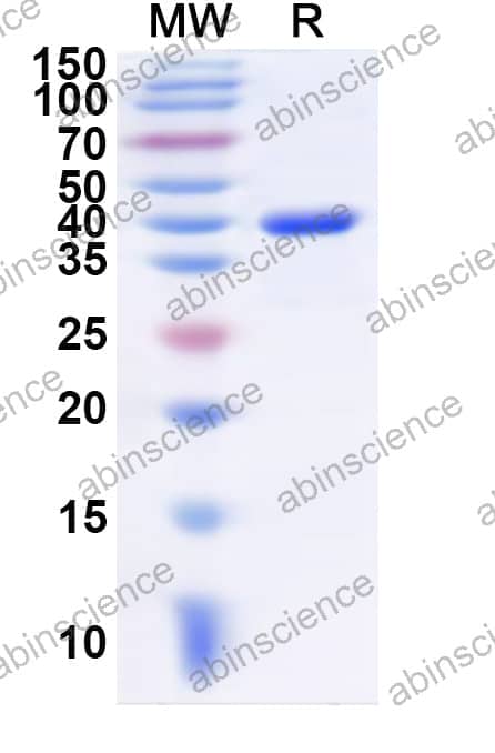 Human PLCB4 Recombinant Protein (N-His)