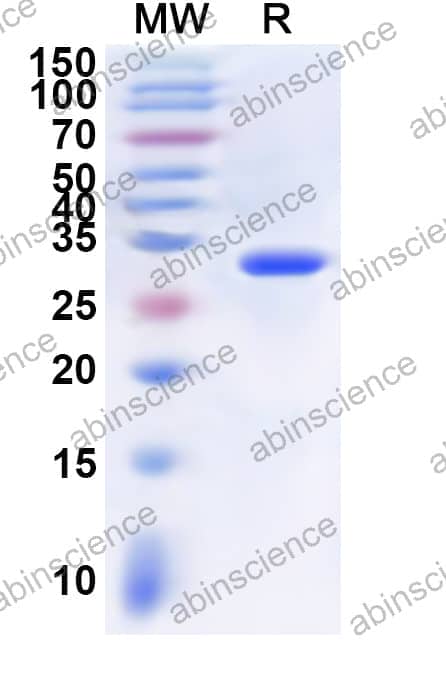 Human QPRT Recombinant Protein (N-His)