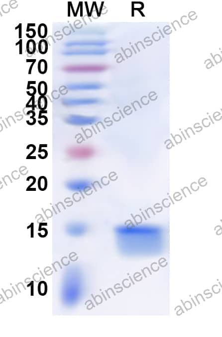 Human DLGAP5 Recombinant Protein (N-His)