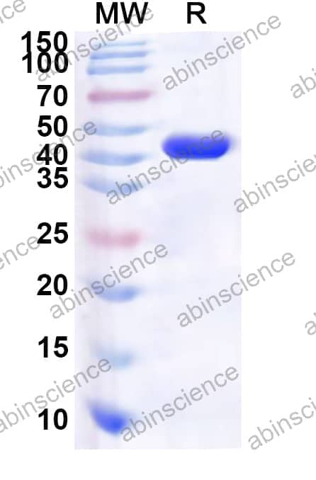 Human SYCP1 Recombinant Protein (N-His)