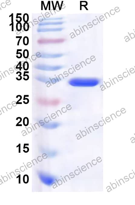Human PPP1R7 Recombinant Protein (N-His)