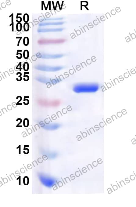 Human TESK1 Recombinant Protein (N-His)