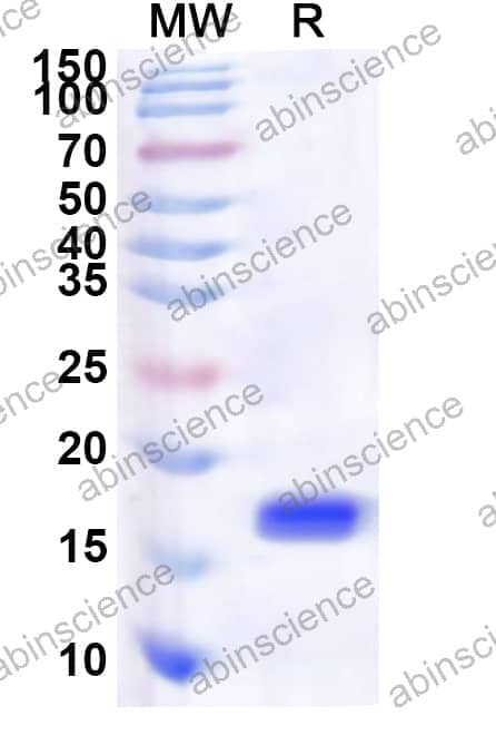 Human NAB2 Recombinant Protein (N-His)