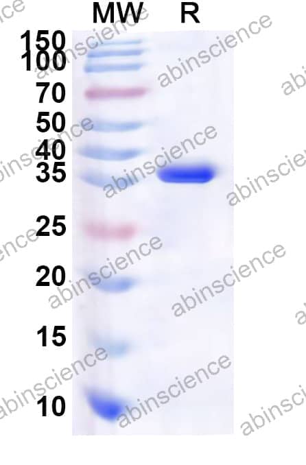 Human TOMM34 Recombinant Protein (N-His)