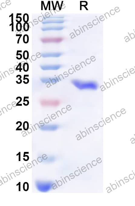 Human NCOA2 Recombinant Protein (N-His)