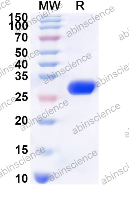Human NCOA1 Recombinant Protein (N-His)