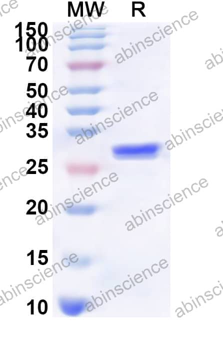 Human CHRNA2 Recombinant Protein (N-His)