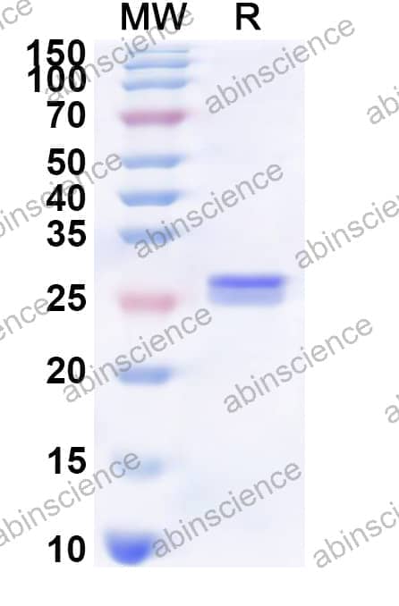 Human SLC15A2 Recombinant Protein (N-His)