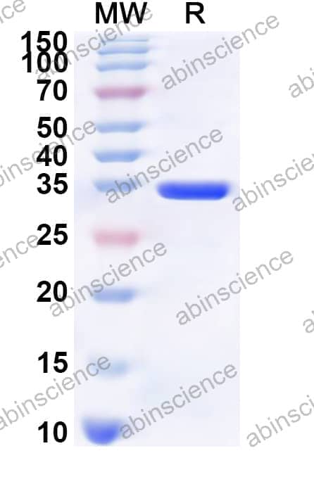 Human INA Recombinant Protein (N-His)