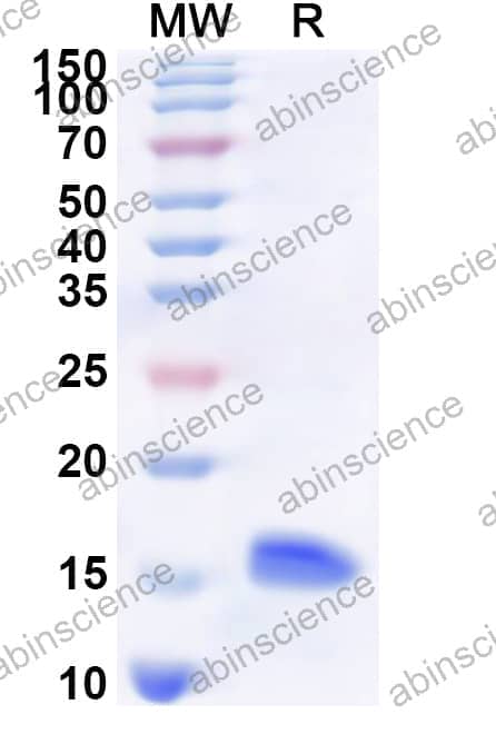 Human KCNMB1 Recombinant Protein (N-His)