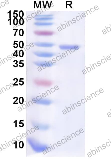 Human POU2AF1 Recombinant Protein (N-His-KSI)