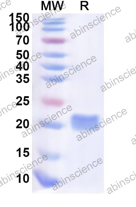 Human ME3 Recombinant Protein (N-His)