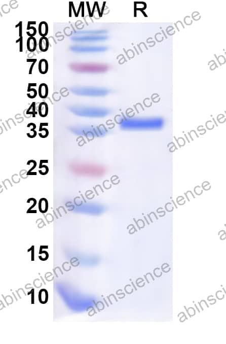 Human SLC19A3 Recombinant Protein (N-GST & C-His)