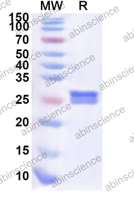 Human SGCA Recombinant Protein (N-His)