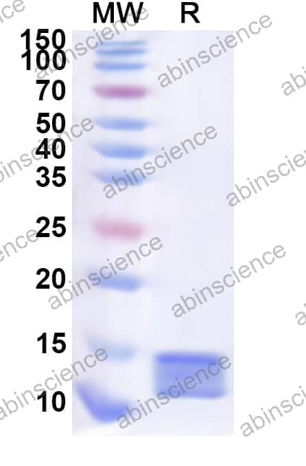 Human DUOXA2 Recombinant Protein (N-His)