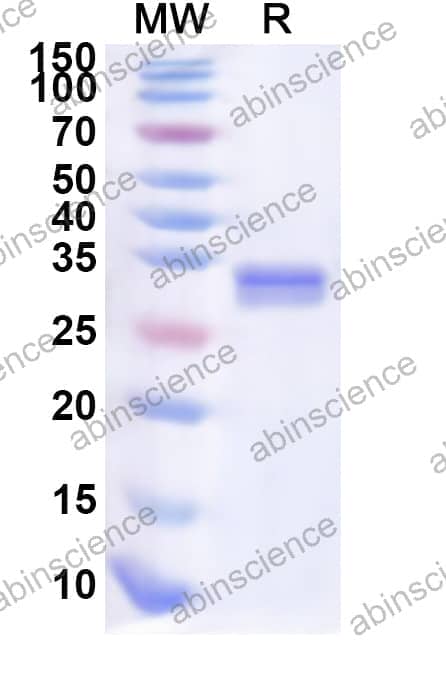 Human PCGF3 Recombinant Protein (N-His)