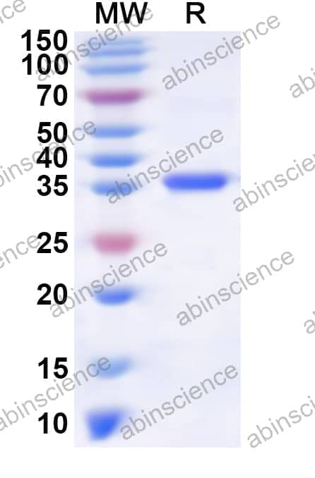 Human KLF9 Recombinant Protein (N-His)