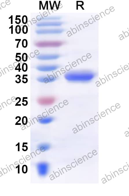 Human KMT5B Recombinant Protein (N-His)