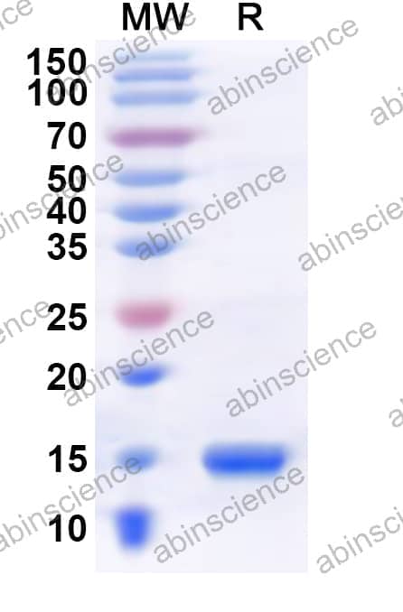 Human BRDT Recombinant Protein (N-His)