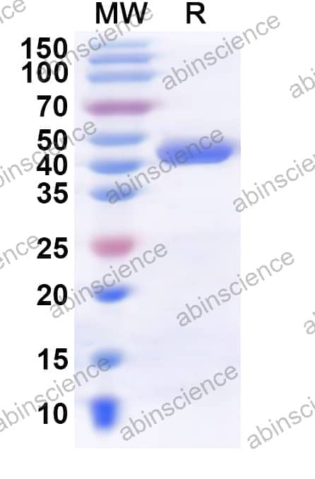 Human CMPK2 Recombinant Protein (N-His)