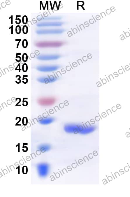 Human RNF212 Recombinant Protein (N-His)