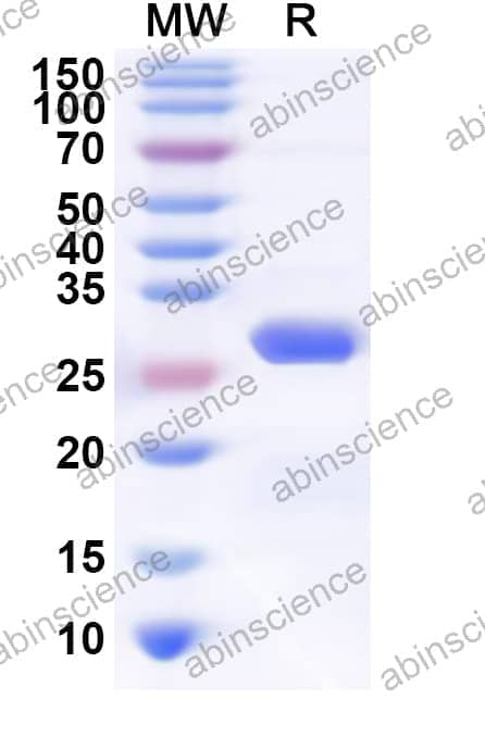 Human TJAP1 Recombinant Protein (N-His)