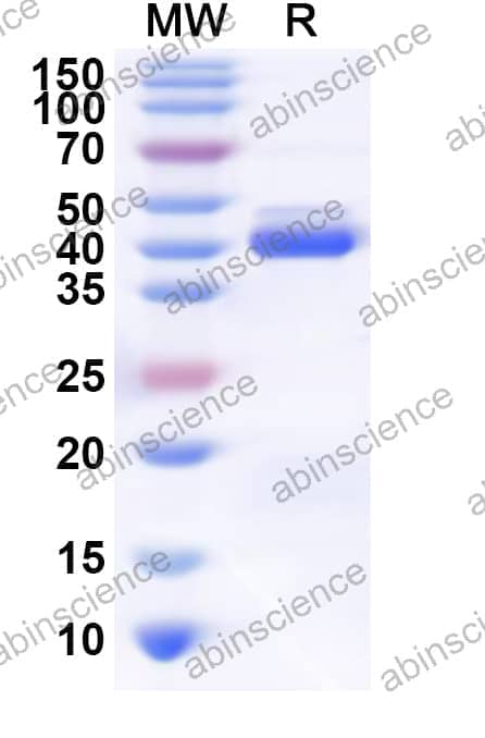 Human SNAPC4 Recombinant Protein (N-His)