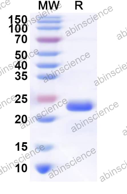 Human OTUD3 Recombinant Protein (N-His)