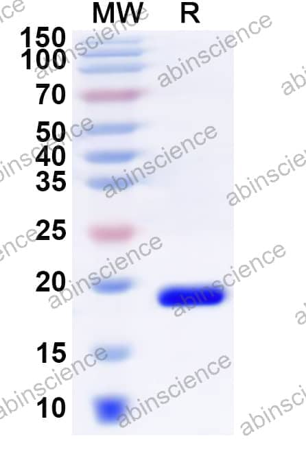 Human ZNF746 Recombinant Protein (N-His)