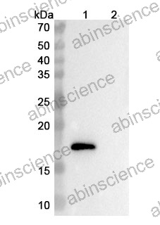 Anti-Human TMEM219 Reference Antibody (Ebrasodebart, RUO)