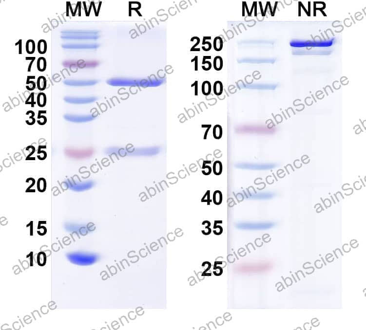 Anti-CELF4/BRUNOL4 Recombinant Antibody (N446/23)