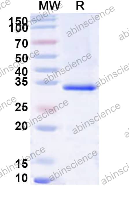 Human ARL6 Recombinant Protein (N-His)