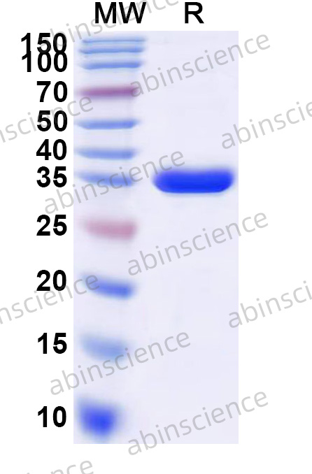 Human MFN1 Recombinant Protein (N-His)