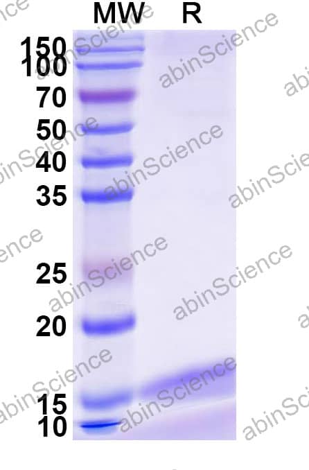 Anti-Human TMEM30A Recombinant Nanobody (FC5)