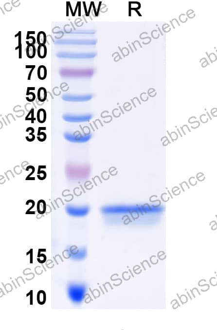Anti-Human TMEM30A Recombinant Nanobody (FC44)