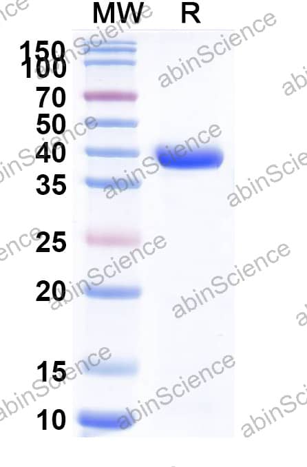 Anti-Human TMEM30A Recombinant Antibody (FC44)